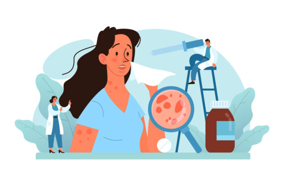 Pelle a tendenza allergica