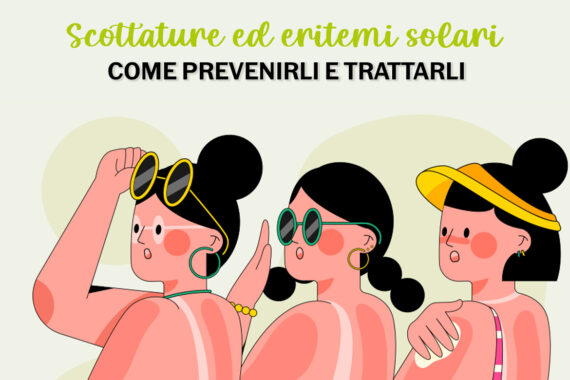 scottature ed eritemi solari