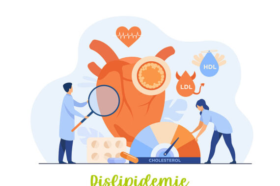 dislipidemie